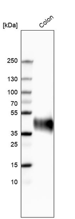 A33 Antibody in Western Blot (WB)