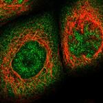 KPNA6 Polyclonal Antibody