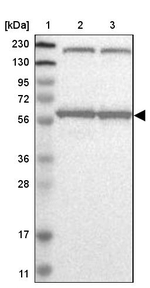 KPNA6 Antibody in Western Blot (WB)