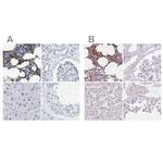 SERPINB1 Polyclonal Antibody