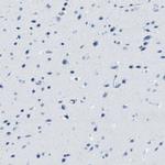 SERPINB1 Antibody in Immunohistochemistry (IHC)