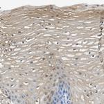 SERPINB1 Antibody in Immunohistochemistry (IHC)
