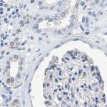 SERPINB1 Antibody in Immunohistochemistry (IHC)