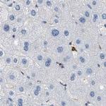 SERPINB1 Antibody in Immunohistochemistry (IHC)