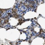 SERPINB1 Antibody in Immunohistochemistry (IHC)