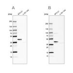 SERPINB1 Antibody in Western Blot (WB)