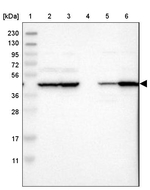 ACCS Antibody in Western Blot (WB)
