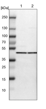 ACCS Antibody in Western Blot (WB)