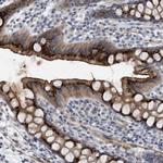 ST6GALNAC6 Antibody in Immunohistochemistry (Paraffin) (IHC (P))