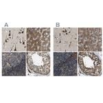 ERGIC1 Antibody in Immunohistochemistry (IHC)