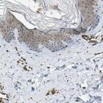 ERGIC1 Antibody in Immunohistochemistry (IHC)