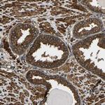 ERGIC1 Antibody in Immunohistochemistry (IHC)