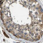 ERGIC1 Antibody in Immunohistochemistry (IHC)