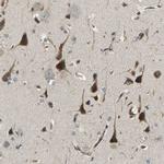 ERGIC1 Antibody in Immunohistochemistry (IHC)