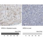 SPEG Polyclonal Antibody