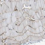 SPEG Antibody in Immunohistochemistry (IHC)