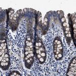 SPEG Antibody in Immunohistochemistry (IHC)