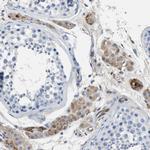 SPEG Antibody in Immunohistochemistry (IHC)