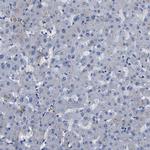 SPEG Antibody in Immunohistochemistry (IHC)