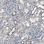 ALX1 Antibody in Immunohistochemistry (Paraffin) (IHC (P))