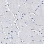 ALX1 Antibody in Immunohistochemistry (Paraffin) (IHC (P))