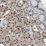 ALX1 Antibody in Immunohistochemistry (Paraffin) (IHC (P))