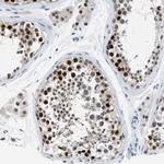 ALX1 Polyclonal Antibody