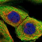 PPP2R1B Polyclonal Antibody