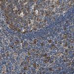 PPP2R1B Antibody in Immunohistochemistry (Paraffin) (IHC (P))