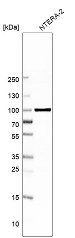 PPP2R1B Antibody in Western Blot (WB)