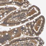 ARHGEF12 Antibody in Immunohistochemistry (Paraffin) (IHC (P))