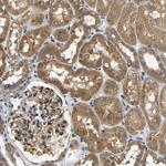 ARHGEF12 Antibody in Immunohistochemistry (Paraffin) (IHC (P))