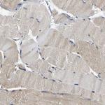 ARHGEF12 Antibody in Immunohistochemistry (Paraffin) (IHC (P))