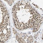 ARHGEF12 Antibody in Immunohistochemistry (Paraffin) (IHC (P))