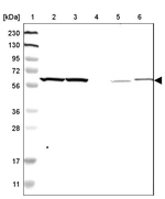 YARS Antibody in Western Blot (WB)