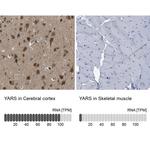 YARS Antibody in Immunohistochemistry (IHC)