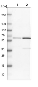 YARS Antibody in Western Blot (WB)