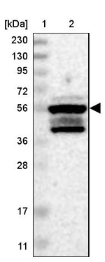 ZNF200 Antibody in Western Blot (WB)