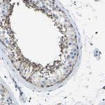 ZNF200 Antibody in Immunohistochemistry (IHC)
