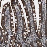 CHN2 Polyclonal Antibody