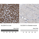 SLC25A13 Antibody in Immunohistochemistry (Paraffin) (IHC (P))