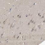 GLTSCR2 Antibody in Immunohistochemistry (Paraffin) (IHC (P))