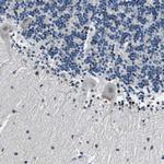 PHLDA1 Antibody in Immunohistochemistry (Paraffin) (IHC (P))