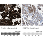 PHLDA1 Antibody in Immunohistochemistry (Paraffin) (IHC (P))