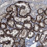 PHLDA1 Antibody in Immunohistochemistry (Paraffin) (IHC (P))