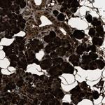 PHLDA1 Antibody in Immunohistochemistry (Paraffin) (IHC (P))