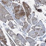 PHLDA1 Antibody in Immunohistochemistry (Paraffin) (IHC (P))