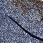 PHLDA1 Antibody in Immunohistochemistry (Paraffin) (IHC (P))