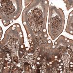 IL17RE Antibody in Immunohistochemistry (Paraffin) (IHC (P))