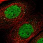 TMEM150A Polyclonal Antibody